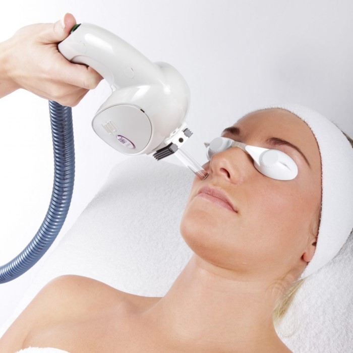 skin rejuvenation machine